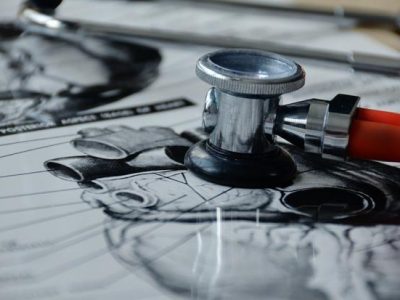 В клинике Мешалкина разработали нейросеть по выявлению инсульта