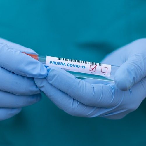 В регионе уже более 11 тыс случаев заражения коронавирусом