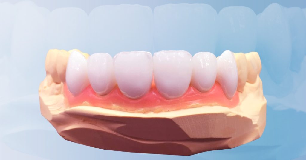 Распространенные стоматологические заболевания и их лечение