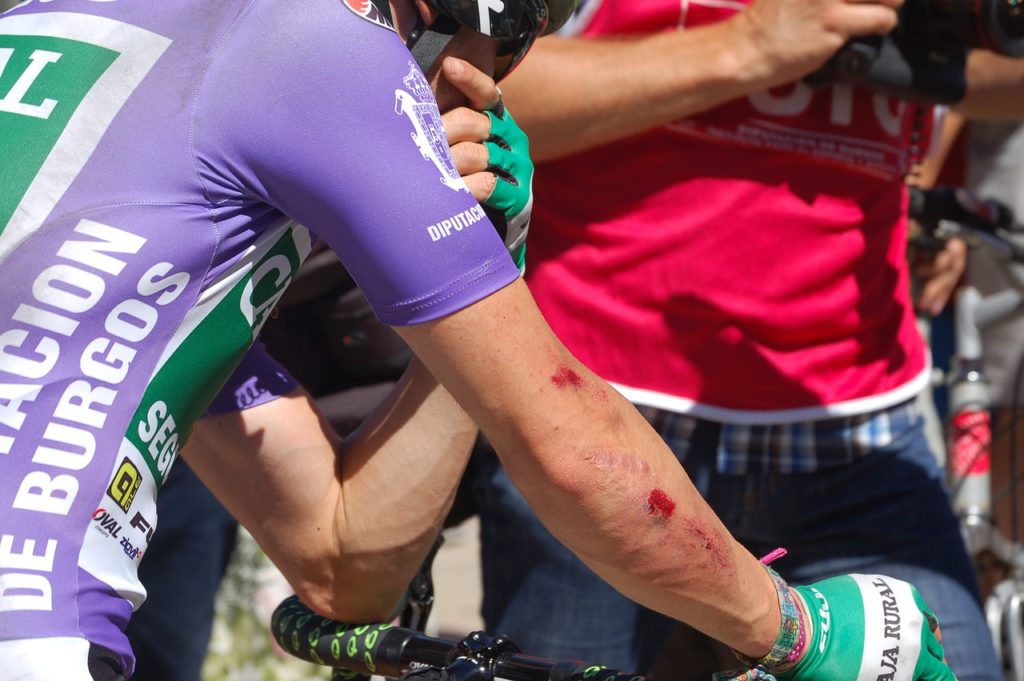 Возбудители описторхоза подсказали ученым новый метод заживления ран