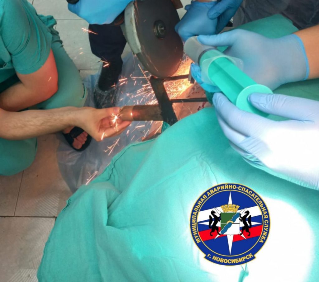 Из головы мужчины спасатели извлекли вилы в Новосибирске