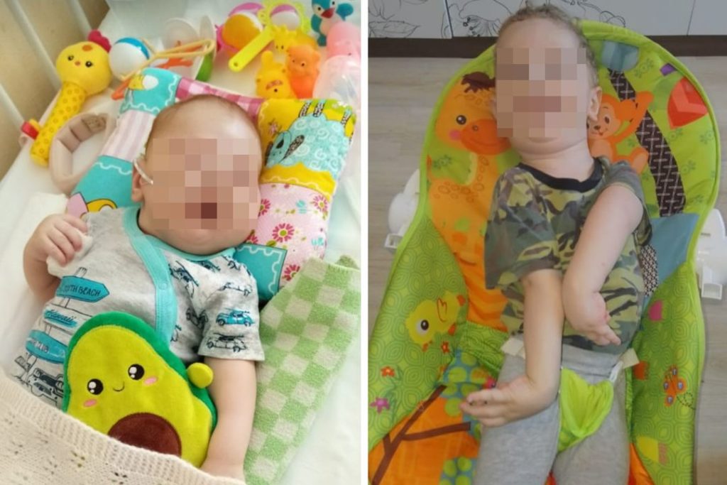 «Он был синий и еле дышал»: младенца-богатыря превратили в инвалида во время родов в Новосибирске
