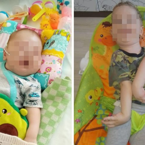 Младенца-богатыря превратили в инвалида во время родов в Новосибирске