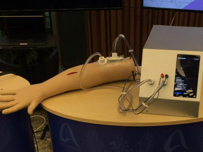 Создан аппарат для лечения ран вакуумом и электричеством в Новосибирске