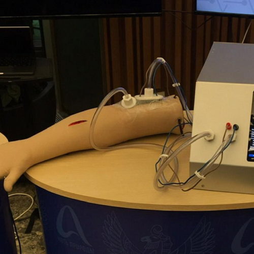 Создан аппарат для лечения ран вакуумом и электричеством в Новосибирске