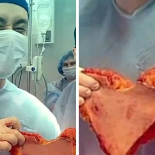 Куском плоти в форме сердца поздравил женщину пластический хирург из Новосибирска