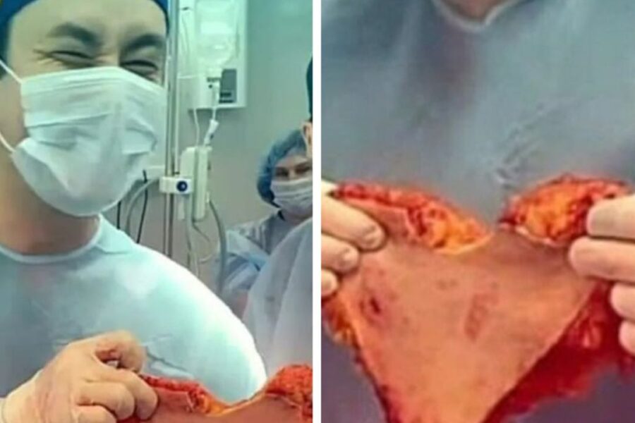 Куском плоти в форме сердца поздравил женщину пластический хирург из Новосибирска