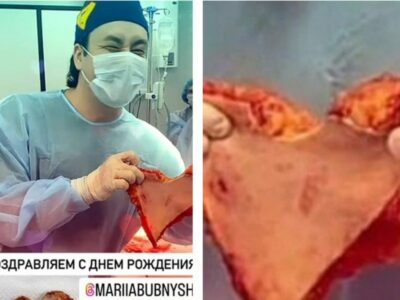 Хирург из Новосибирска, вырезающий поделки из человеческой кожи, попал под статью