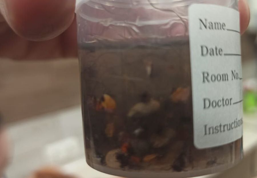 «Только дыхание и сердцебиение»: волонтеры спасли умирающего медвежонка в лесу под Новосибирском