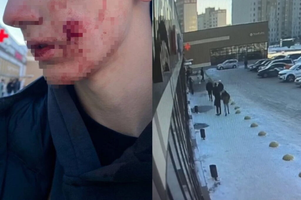 Молодому парню выстрелили в лицо из сигнального пистолета в Новосибирске