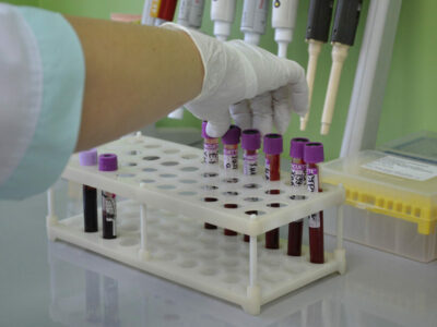 Лишайник против COVID-19: новосибирские учёные создали средство, подавляющее все штаммы коронавируса