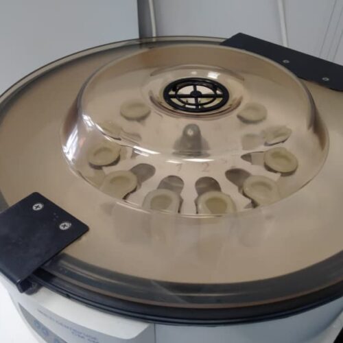 В Новосибирске после вспышки коклюша выросло число положительных тестов на антитела