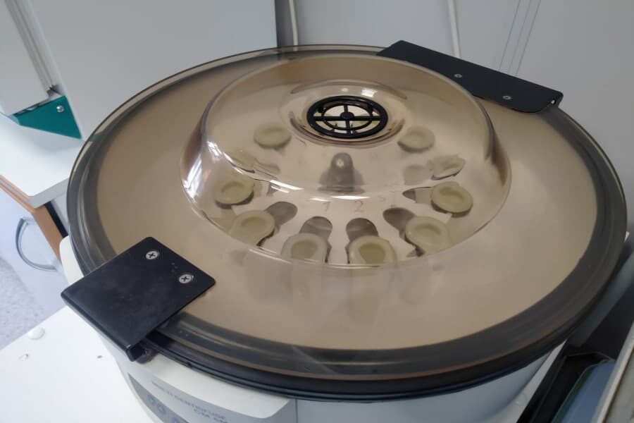 В Новосибирске после вспышки коклюша выросло число положительных тестов на антитела