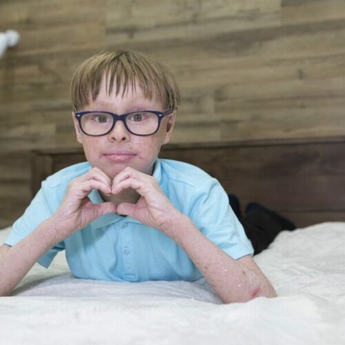 Русфонд собирает средства на приобретение мазей и кремов для ребенка с ихтиозом