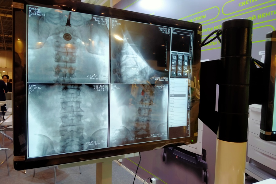 «Мы пока не доверяем нейросети и все перепроверяем»: в Новосибирске нейрохирург рассказал, как на самом деле врачи относятся к ИИ